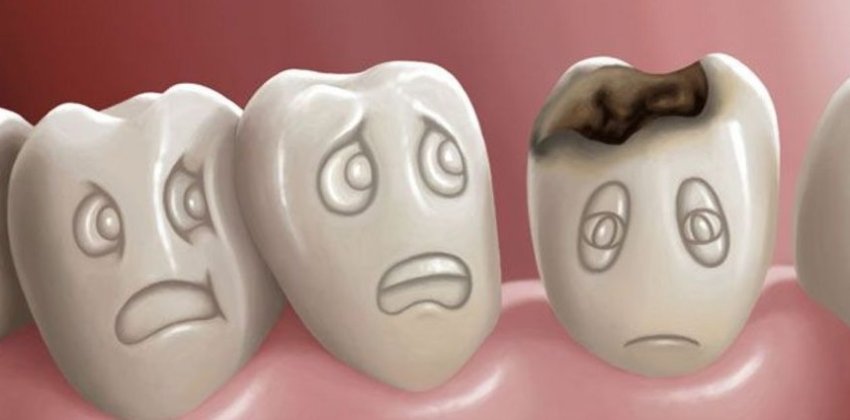 Как защитить зубы от кариеса - «Здоровье»