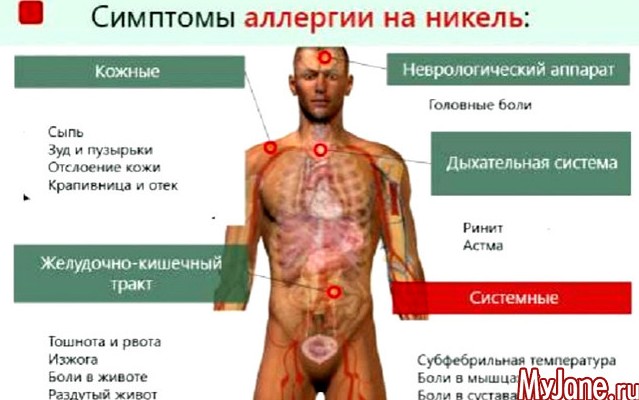 Аллергия на металл - «Здоровье»