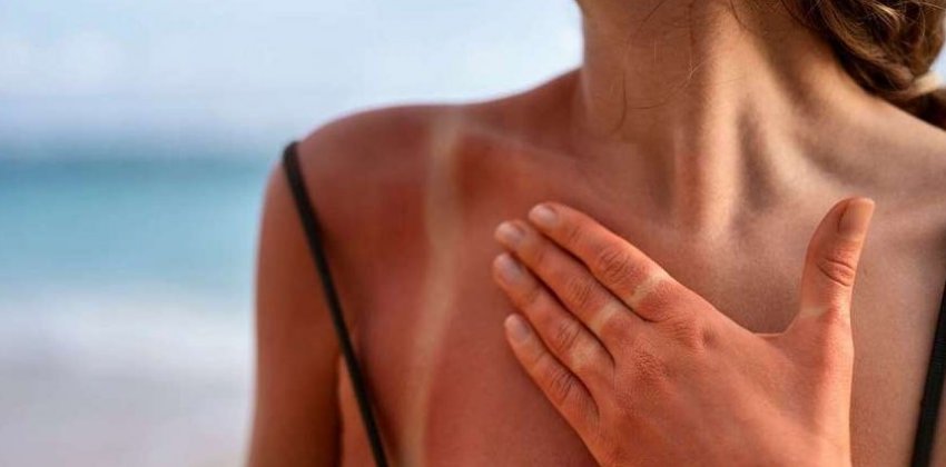 Как позаботится о коже летом - «Здоровье»